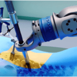 Spinal Robotic Technology
